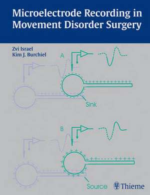 Microelectrode Recording in Movement Disorder Surgery de Zvi Israel