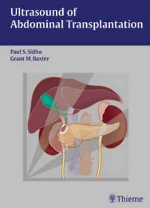 Ultrasound of Abdominal Transplantation de Paul S. Sidhu