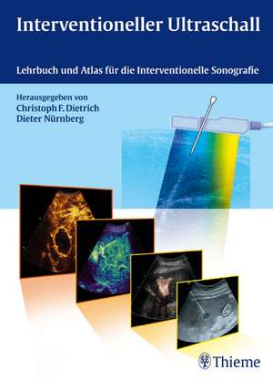 Interventioneller Ultraschall de Christoph Frank Dietrich