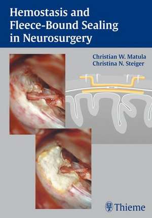 Hemostasis and Fleece-Bound Sealing in Neurosurgery de Christian Matula