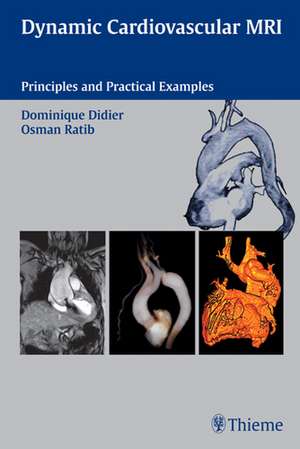 Dynamic Cardiovascular MRI (incl. CD-ROM): Principles and Practical Examples de Dominique Didier