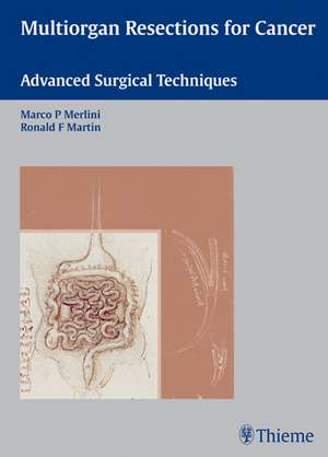 Multiorgan Resections for Cancer: Advanced Surgical Techniques de Marco Merlini