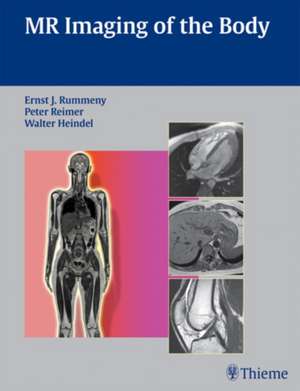 MR Imaging of the Body de Ernst Rummeny