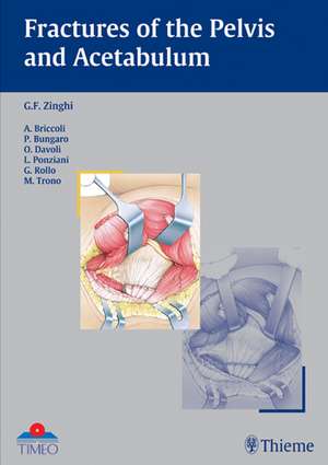 Fractures of the Pelvis and Acetabulum de Gianfranco Zinghi