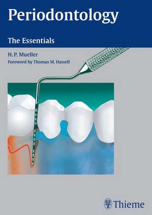 Periodontology: The Essentials de Hans-Peter Mueller