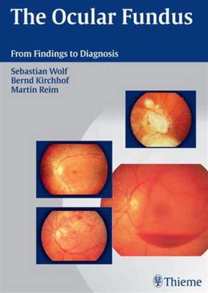 Ocular Fundus: From Findings to Diagnosis de Sebastian Wolf