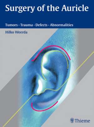 Surgery of the Auricle – Tumors–Trauma–Defects–Abnormalities de Hilko Weerda