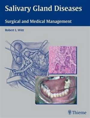 Salivary Gland Diseases de Robert L. Witt