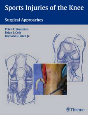 Sport Injuries of the Knee de Peter T. Simonian