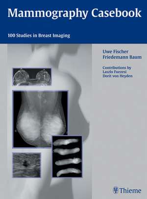 Mammography Casebook de Uwe Fischer