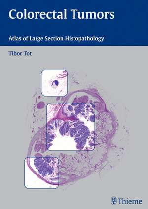 Colorectal Tumors: Atlas of Large Section Histopathology de Tibor Tot