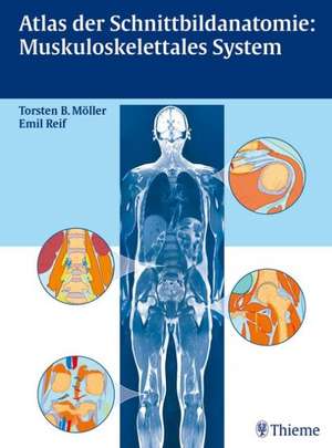 Atlas der Schnittbildanatomie: Muskuloskelettales System de Torsten Bert Möller
