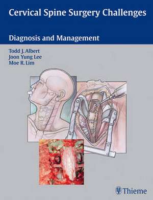 Cervical Soine Surgery Challenges de Todd J. Albert