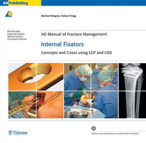 AO Manual of Fracture Management: Internal Fixat – Concepts and Cases using LCP/LISS de Michael Wagner