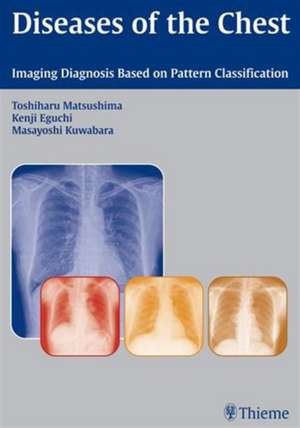 Diseases of the Chest: Imaging Diagnosis Based on Pattern Classification de Toshiharu Matsushima