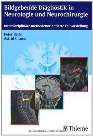 Bildgebende Diagnostik in der Neurologie und Neurochirurgie de Peter Berlit