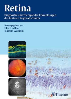 Retina de Ulrich Kellner