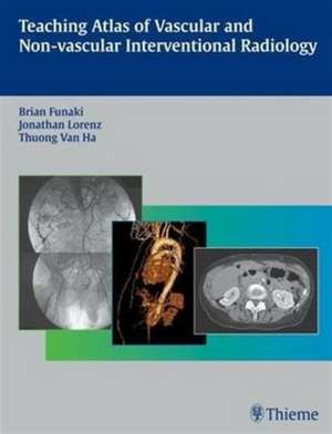 Teaching Atlas of Vascular and Non-vascular Interventional Radiology de Brian Funaki