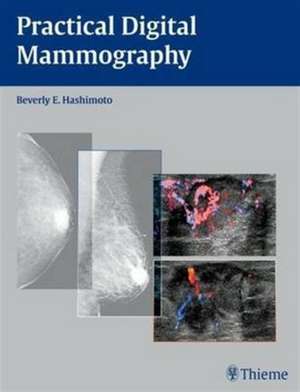 Practical Digital Mammography de Beverly Hashimoto