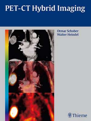 PET–CT Hybrid Imaging de Otmar Schober