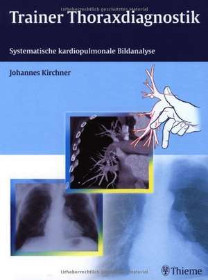 Trainer Thoraxdiagnoistik de Johannes Kirchner