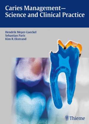 Caries Management - Science and Clinical Practice de Hendrik Meyer-Lueckel