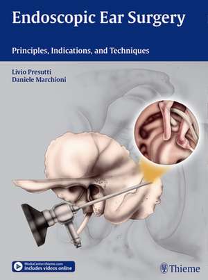 Endoscopic Ear Surgery – Principles, Indications, and Techniques de Livio Presutti