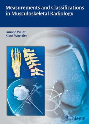 Measurements and Classifications in Musculoskeletal Radiology de Simone Waldt