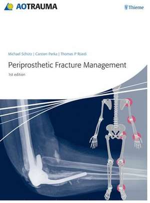 Periprosthetic Fracture Management de Michael Schütz