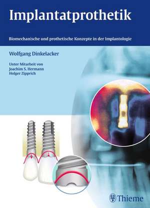 Implantatprothetik de Wolfgang Dinkelacker