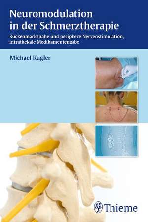 Neuromodulation in der Schmerztherapie de Michael Kugler