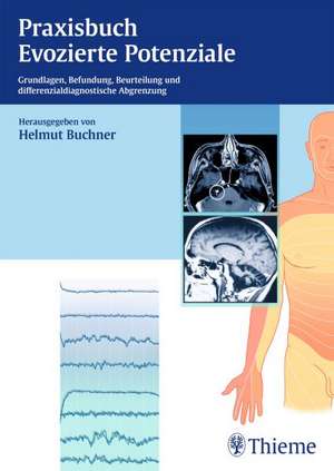 Praxisbuch Evozierte Potenziale de Helmut Buchner