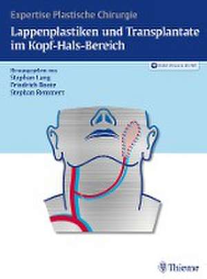 Lappenplastiken und Transplantate im Kopf-Hals-Bereich de Stephan H. Lang