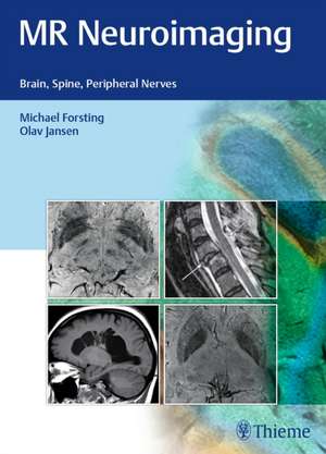 MR Neuroimaging – Brain, Spine, Peripheral Nerves de Michael Forsting