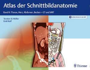 Atlas der Schnittbildanatomie de Torsten Bert Möller