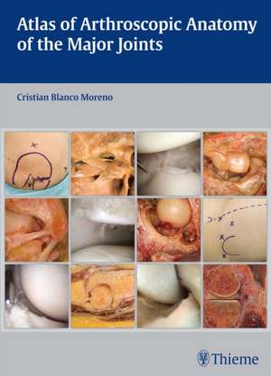 Atlas of Arthroscopic Anatomy of the Major Joints de Cristian Blanco Moreno