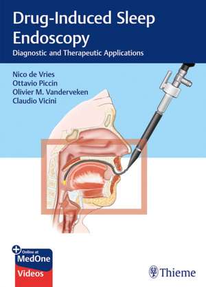 Drug–Induced Sleep Endoscopy – Diagnostic and Therapeutic Applications de Nico De Vries