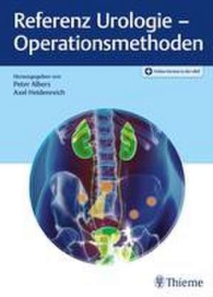 Referenz Urologie - Operationsmethoden de Peter Albers