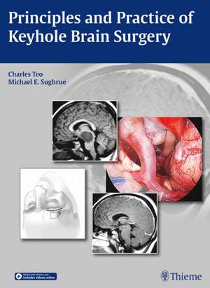 Principles and Practice of Keyhole Brain Surgery de Charles Teo