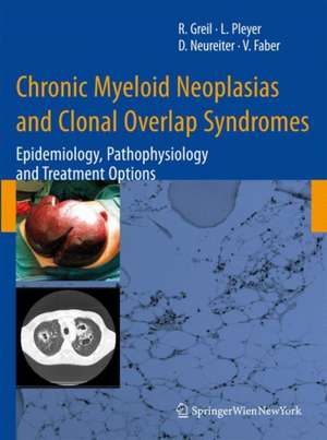 Chronic Myeloid Neoplasias and Clonal Overlap Syndromes: Epidemiology, Pathophysiology and Treatment Options de Richard Greil