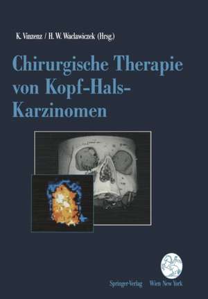 Chirurgische Therapie von Kopf-Hals-Karzinomen de Kurt Vinzenz