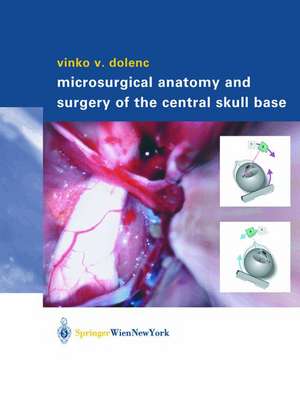 Microsurgical Anatomy and Surgery of the Central Skull Base de L. Rogers