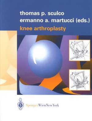 Knee Arthroplasty de Thomas P. Sculco