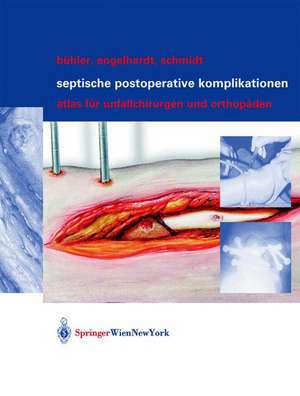 Septische postoperative Komplikationen: Atlas für Unfallchirurgen und Orthopäden de Matthias Bühler