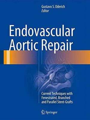 Endovascular Aortic Repair: Current Techniques with Fenestrated, Branched and Parallel Stent-Grafts de Gustavo S. Oderich