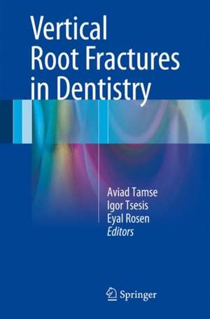 Vertical Root Fractures in Dentistry de Aviad Tamse