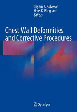 Chest Wall Deformities and Corrective Procedures de Shyam Kolvekar