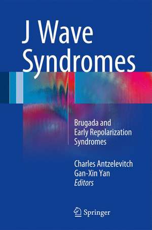 J Wave Syndromes: Brugada and Early Repolarization Syndromes de Charles Antzelevitch