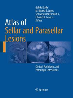 Atlas of Sellar and Parasellar Lesions: Clinical, Radiologic, and Pathologic Correlations de Gabriel Zada