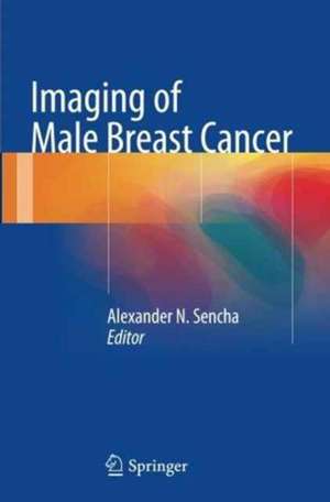 Imaging of Male Breast Cancer de Alexander N. Sencha